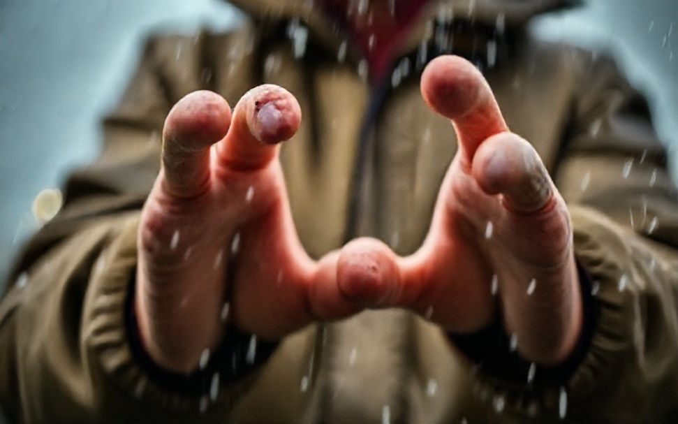 5 Ways to Stay Safe During Crawley’s Extreme Weather Events*