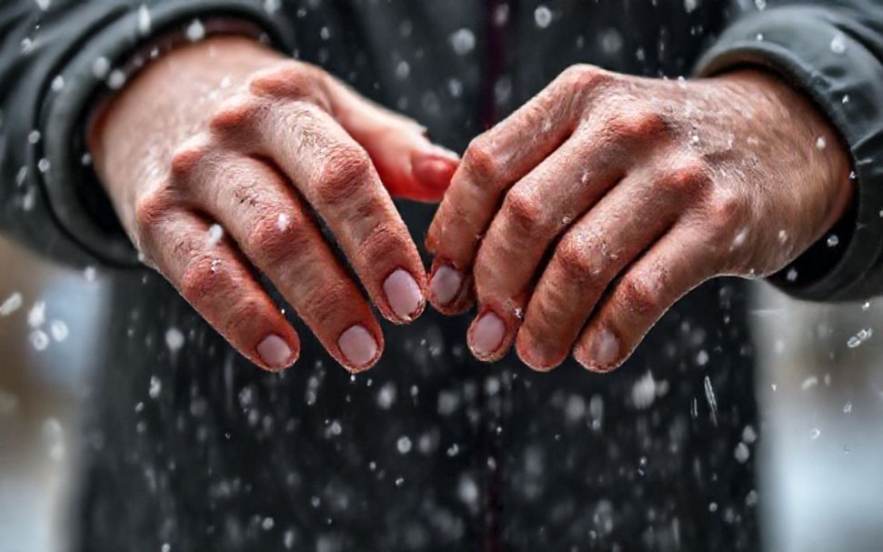 5 Ways to Stay Safe During Extreme Weather in Crawley*